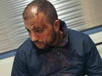 مستوطنون يعتدون بالضرب المبرح على سائق حافلة عربي