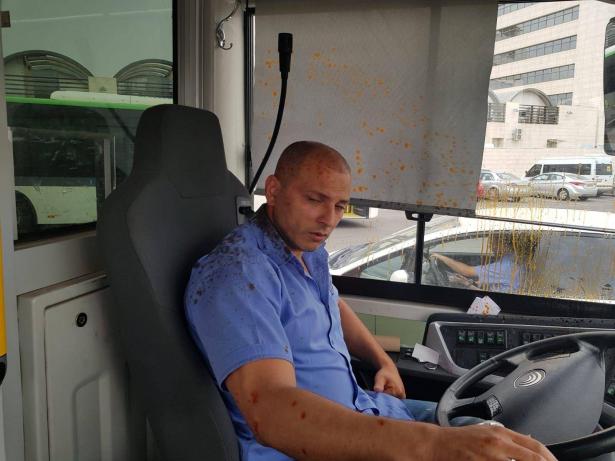 ادهم بدير سائق الحافلة من كفرقاسم يروي للشمس تفاصيل الاعتداء الوحشي عليه  من قبل 3 متطرفين يهود