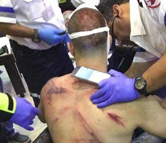 توثيق بالفيديو: شجار عنيف في مقهى بمدينة سخنين اصيب من خلاله شاب من عرابه بجراح متوسطة