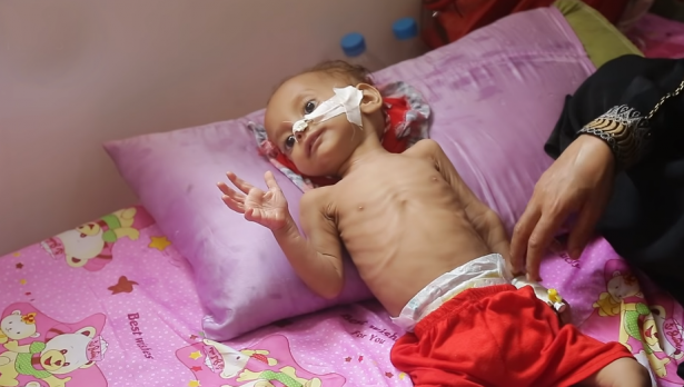يونيسف: 6000 طفل يمني بين قتيل وجريح منذ بداية الحرب
