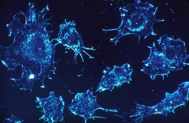 بعد عام واحد.. علماء يدعون اكتشاف أول علاج نهائي للسرطان