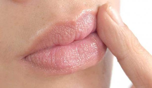 أفضل العلاجات لالتهاب زوايا الفم