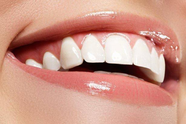 حقائق عن نظام تبييض الأسنان اللامع