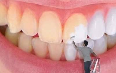 خيارات تبييض الأسنان