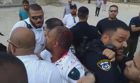 شاهد: الشرطة تعتدي على حارس المسجد الاقصى مهند ادريس اثناء اعتقاله