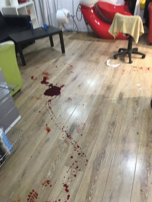 من مكان الحادث في طمرة - تصوير ناشطين 