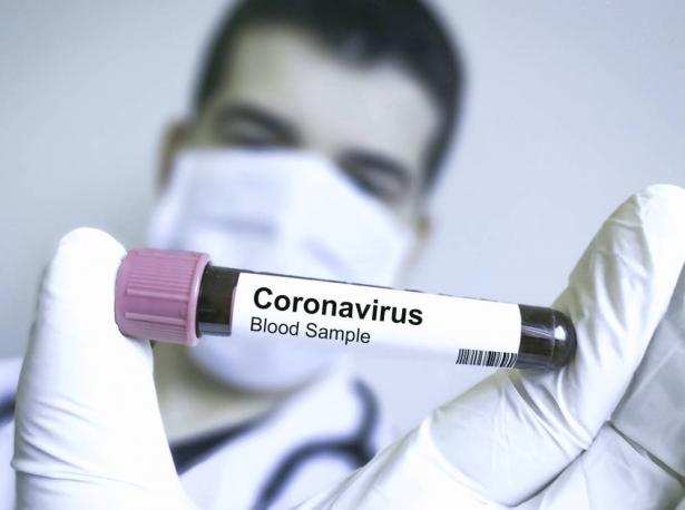 كفر قرع : تسجيل اربع اصابات بفيروس كورونا