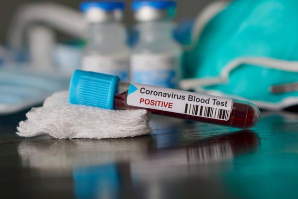 الصحة الاسرائيلية:  1549 إصابة جديدة بفيروس كورونا في البلاد