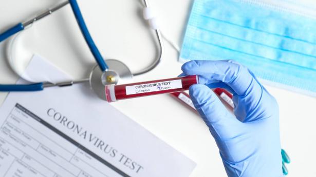 وزارة الصحة: 1672 إصابة جديدَة بفيروس كورونا وعدد الوفيات يصل إلى 576 حالة