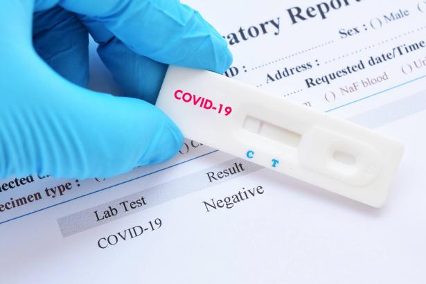 وزارة الصحة الاسرائيلية تعلن عن تسجيل 554 إصابة جديدة بفيروس كورونا
