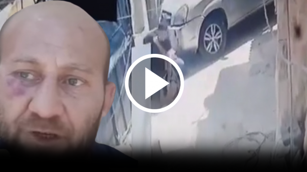 توثيق بالفيديو من القدس: الاعتداء على الشاب فادي عبد الرحمن محيسن من ذوي الاحتياجات الخاصة بوحشية