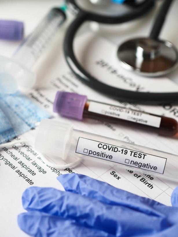 وزارة الصحة: تسجيل 8 حالات وفاة جراء الإصابة بفيروس كورونا
