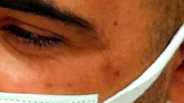 تجميد العمل بخط الحافلات 113 لساعتين بعد الاعتداء على سائق