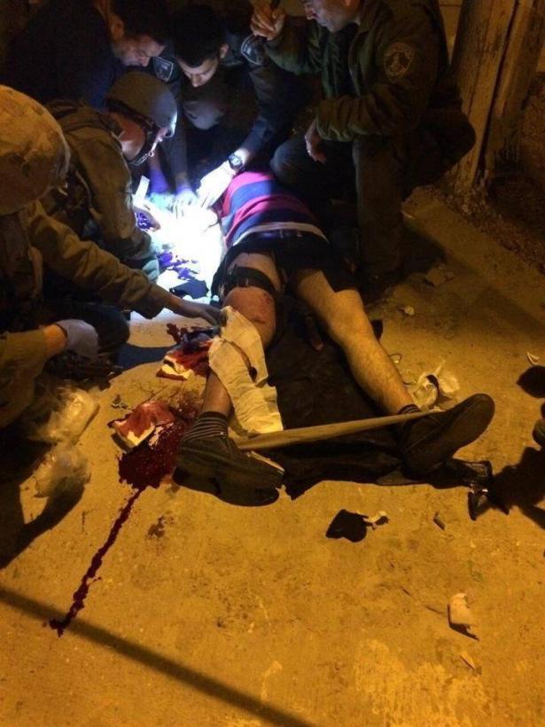 شجار عنيف وإصابة شخص في دير حنا