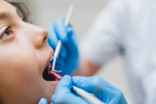 تسوس الاسنان عند الاطفال وكيف يمكن أن نعودهم على تنظيف الاسنان من عمر مبكر؟