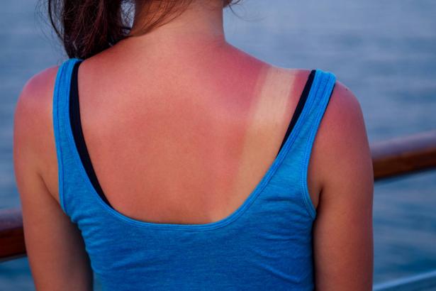 ما هو تأثير أشعة الشمس المباشرة في الأيام الحارة على الجسم وخلايا الجلد؟