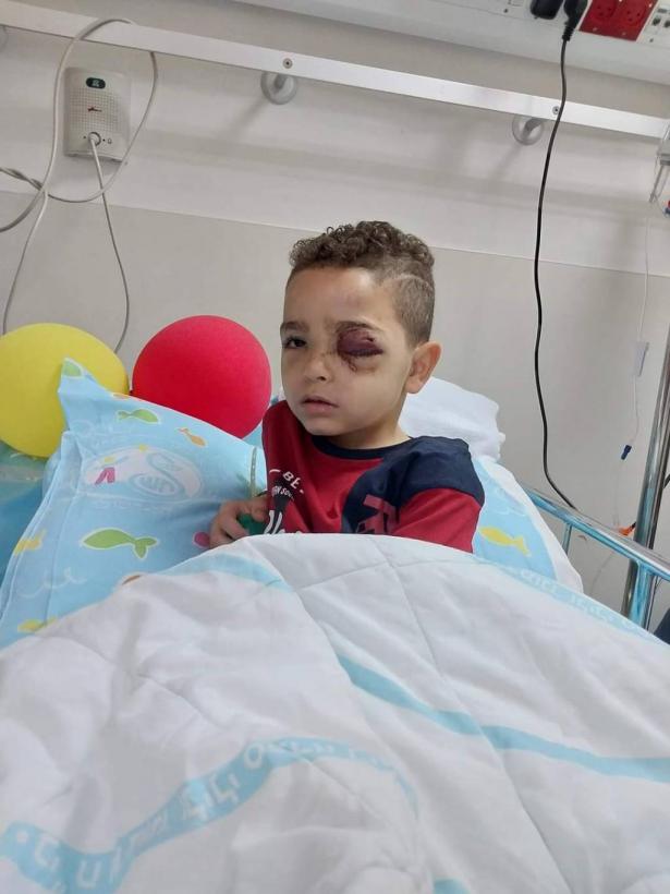 بفعل رصاصة إسرائيلية، فقد الطفل خالد ملالحة عينه للأبد!