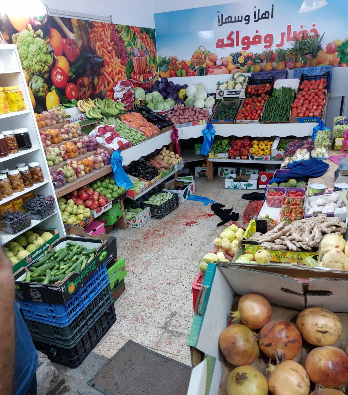 إصابة شخص بجريمة إطلاق نار في كفركنا