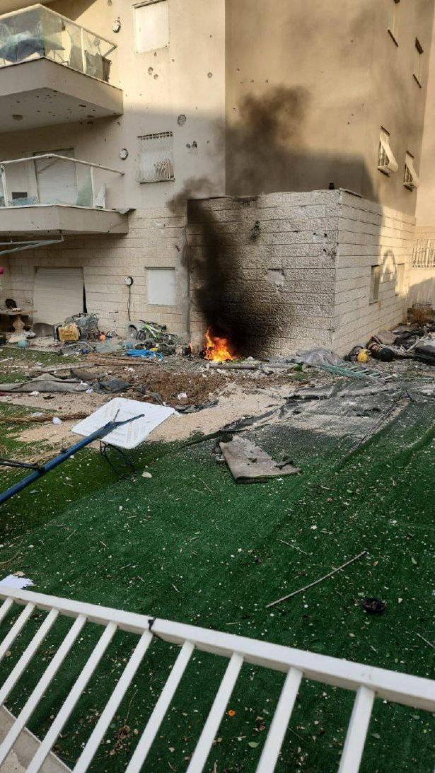 299 مصابًا اسرائيليًا منذ بداية الحرب على غزة يتلقون العلاج، 47 منهم في حالة خطيرة