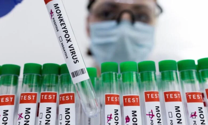 جدري القردة-منصة إكس 