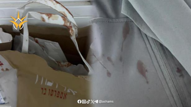 الطالبة أسيل التميمي تتعرض لاعتداء عنيف في القدس: 