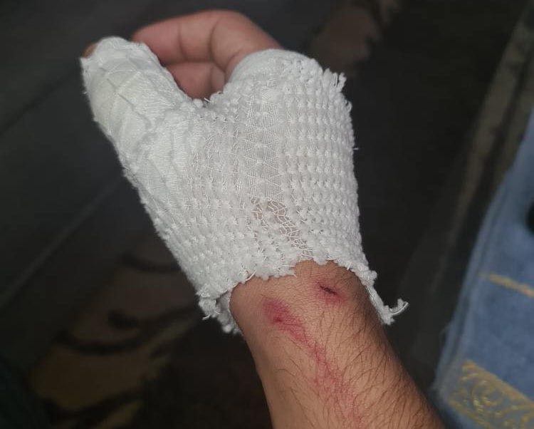 الطالب عوض بربور من أم الفحم يروي لـ 