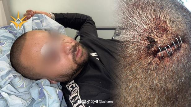 عضو بلدية تل أبيب يافا: الحكومة تشعل العنف في المدن المختلطة وتعاملنا كأعداء