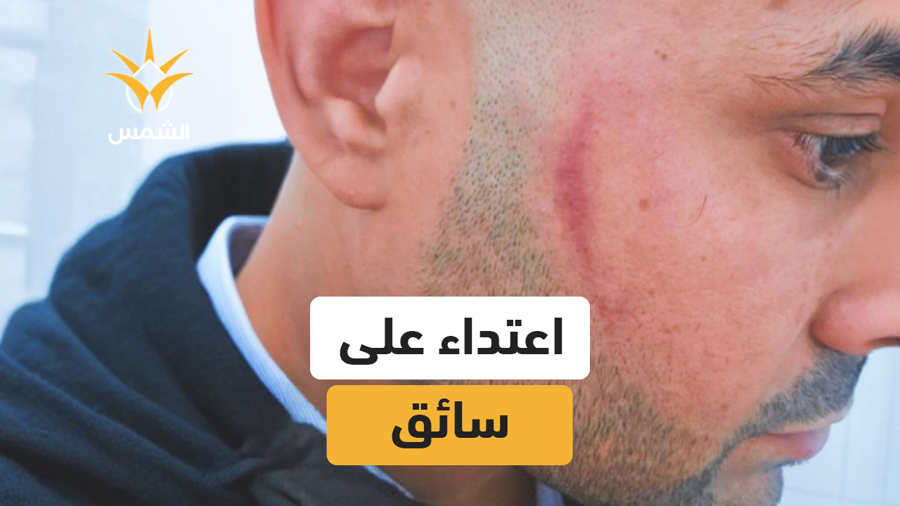 سائق باص يتعرّض للضرب بعد تحاوز خطِر في العفولة