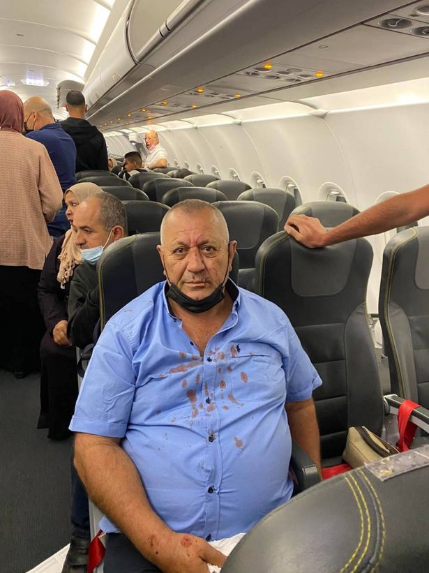 سقوط طائرة تركية بعد تحليقها بثوانٍ وإصابات لعرب من البلاد