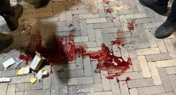 الطيرة: مصرع شاب من الطيبة واصابة آخر في حادث اطلاق نار