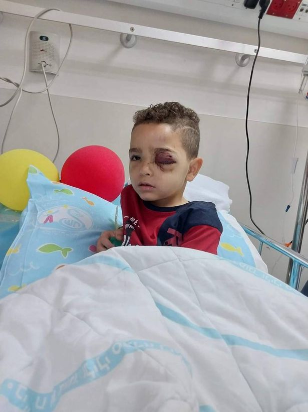 بفعل رصاصة إسرائيلية، فقد الطفل خالد ملالحة عينه للأبد! 