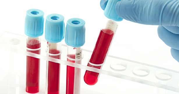 حموضة الدم: دراسة شاملة للأعراض والأسباب وطرق الوقاية