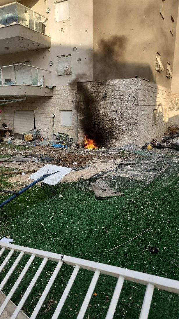 299 مصابًا اسرائيليًا منذ بداية الحرب على غزة يتلقون العلاج، 47 منهم في حالة خطيرة
