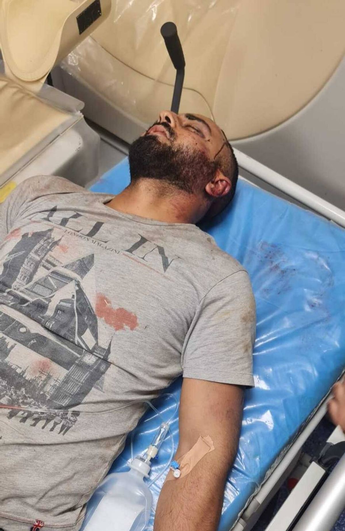 ليث العويني بعد الاعتداء عليه 