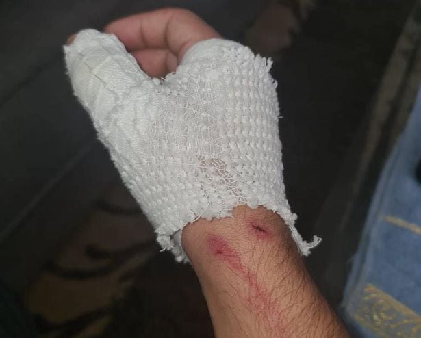 الطالب عوض بربور من أم الفحم يروي لـ "الشمس" تفاصيل الاعتداء العنصري عليه في كريات أونو