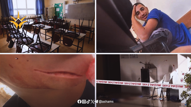 في يوم الطفل العالمي.. أي مستقبل لأطفال يكبرون بين العنف واليُتم والمدارس غير الآمنة؟