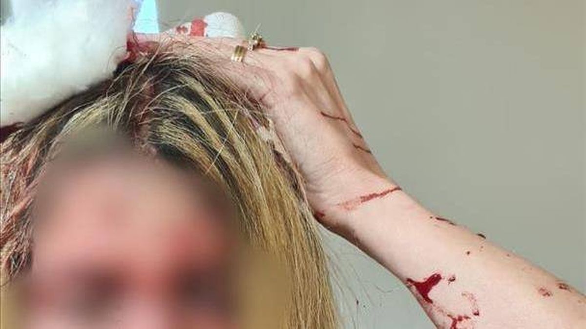 ضرب الطبيبة بمطرقة "شنيتسل"!