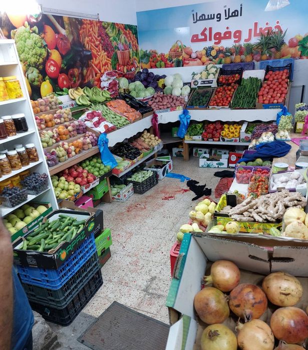 إصابة شخص بجريمة إطلاق نار في كفركنا